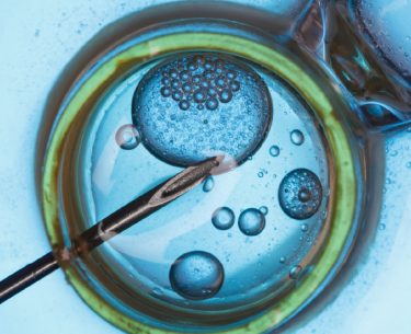 In-vitro-Fertilisation by Prof Ng Soon-Chye