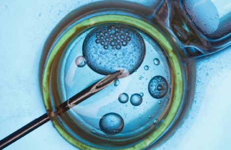 in-vitro-fertilisation-by-prof-ng-soon-chye