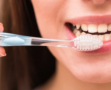 Teeth Whitening by Dr Raymond Lim